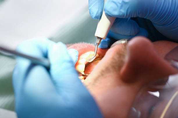 Best Mobile Emergency Dentist in Carthage, TX