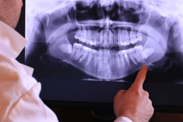 Best Pediatric Emergency Dentist in Carthage, TX