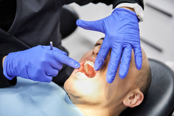 Best Emergency Dentist for Lost Fillings or Crowns in Carthage, TX