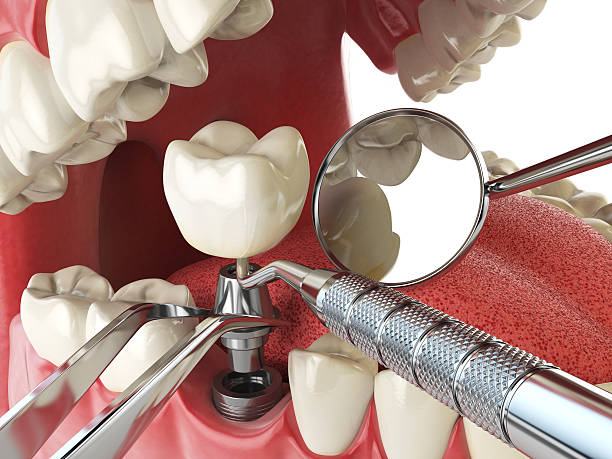 Best Orthodontic Emergency Dentist in Carthage, TX